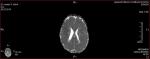 МРТ головного мозга ребенка фото 1