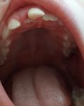 Как поступить с зубом у ребёнка? фото 1