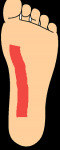 Возникает боль при нажатии на определенные участки ноги фото 2