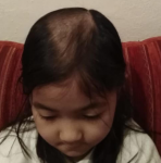 У ребенка волосы выпадает фото 1
