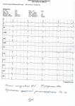Изменени в кардиограмме фото 1