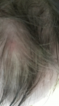 Белые прыщики на голове в волосах фото 2