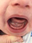 Лезет ли зуб фото 1