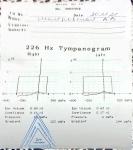 Жидкое содержимое в полости среднего уха фото 3