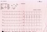 Помощь в расшифровке ЭКГ фото 1