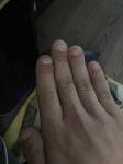 Проблема ногтей фото 1