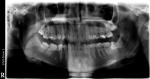Оцените панораму зубов фото 1