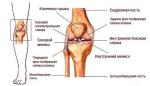 Боль в левом коленном суставе фото 1