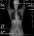 Здравствуйте, что можна сказать о брюшной полости по картинке томографа? фото 1