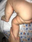 Огромные сухие пятна на ножках у малыша фото 2