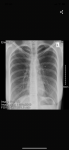 Вопрос по рентгену лёгких фото 2