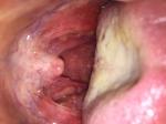 Болит горло без температуры фото 1