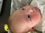 Сыпь И покраснения у новорожденного фото 3