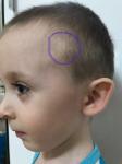 Шишка на голове ребёнка фото 1