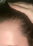 Выпадение волос на определенных участках фото 1