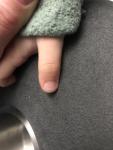 Полоска на ногте большого пальца фото 1