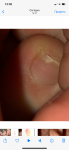 Маленькая царапина на ногте фото 5
