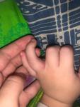 Мелкая сыпь на ручках у ребёнка 2 года фото 2