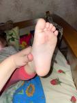 Пятна на ступнях у ребенка фото 1