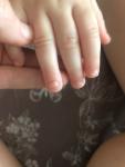Белые пятна на ногтях у ребёнка фото 1