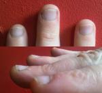 Изменение ногтей фото 1