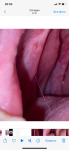 Слизистая рта после операции фото 1