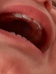 Зуб за зубом фото 1