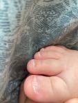 Плохие ногти на ногах у маленького ребёнка фото 2