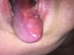 Пятно на языке после травмы фото 4