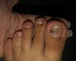 Странные ногти на ногах фото 1