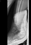 Расшифровка рентгеновского снимка правого голеностопного сустава в двух проекциях фото 2