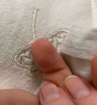 Опухли подушечки пальцев у ребёнка 7 лет фото 1