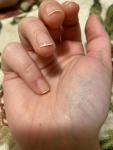 Красные продольные полосы на ногтях после покрытия гель-лаком фото 3