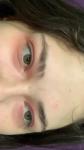 Аллергия у мастера маникюра на глазах фото 2