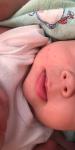 Сыпь у новорожденного у рта фото 1