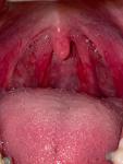 Болит горло без орви фото 1