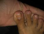 Странные ногти на ногах фото 2