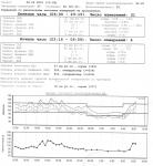 Расшифровать результаты обследований АД и ЭКГ монитора фото 1