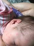 Высыпания на щеках у ребенка фото 4