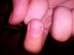 Грубая кожа на пальце фото 2