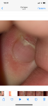 Маленькая царапина на ногте фото 1