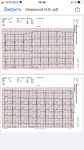 Вопрос по расшифровке и заключению экг фото 1