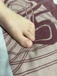 Деформация ногтей у ребенка фото 3