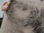 Белый клок волос на бороде фото 1