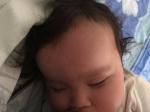 Шишка на голове у ребенка 8 месяцев без симптомов фото 1