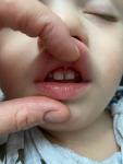Белые пятна на зубах у ребенка фото 1