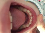 Смена молочных зубов фото 1
