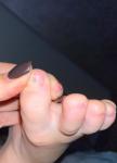 Коричневое пятнышко на ногте ноги фото 2