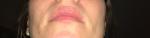 Воспаленные губы фото 2