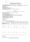 Расшифровка суточного мониторинга ЭКГ и рекомендации фото 1